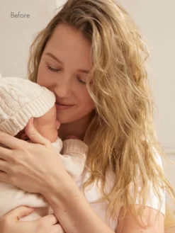 12" Bronde Balayage Thinning Hair Fill-Ins (50g) -Hair Extensions Shop Luxy Hair Extensions OnFig 4thTrimester Bryar 1 Before